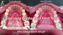 Nha Khoa Minh Nhựt