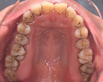 Nha Khoa Master Smile ✅ Thạc sĩ Bác sĩ Niềng Răng Uy tín | Trồng răng Implant Bọc răng sứ Dán răng sứ Nha khoa Uy tín Quận 10