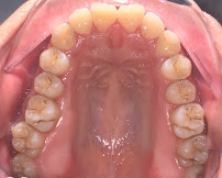 Nha Khoa Master Smile ✅ Thạc sĩ Bác sĩ Niềng Răng Uy tín | Trồng răng Implant Bọc răng sứ Dán răng sứ Nha khoa Uy tín Quận 10