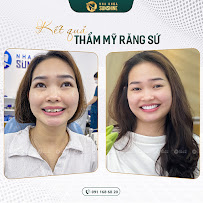 Nha Khoa Sunshine Sài Gòn