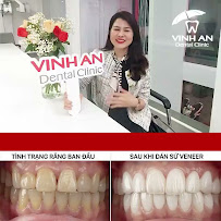 Nha Khoa Vinh An - Nha Khoa Tân Bình