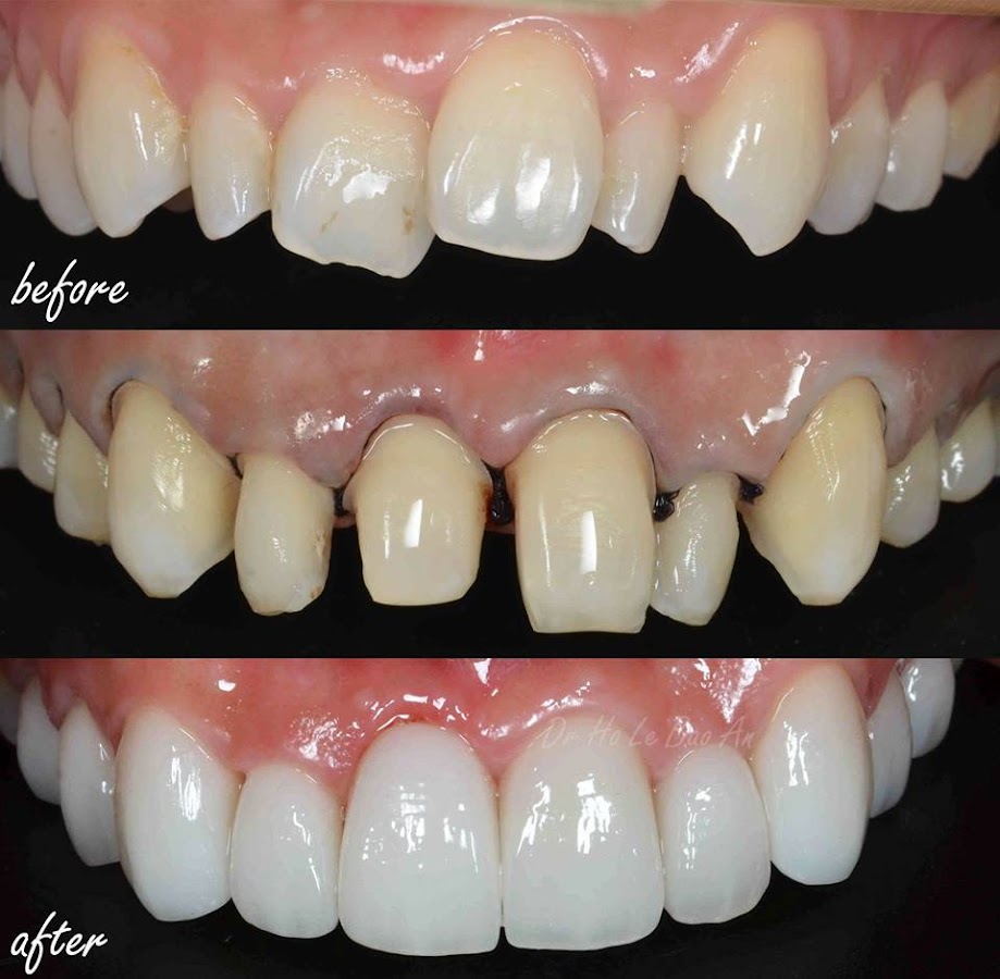 Nha Khoa Tan Binh dental clinic