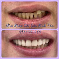 Nha Khoa Sài Gòn Bình Tân