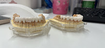 Nha Khoa Thiện Tâm Tân Bình - Chuyên bọc răng sứ, trám răng, tẩy trắng, cạo vôi răng, nhổ răng