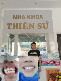 NHA KHOA THIÊN SỨ BT | NHA KHOA UY TÍN Ở BÌNH TÂN
