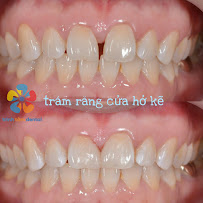 Nha khoa Trinh Tâm | Nha khoa trẻ em Tân Phú | Nha khoa nhổ răng khôn Tân Phú