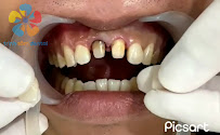 Nha khoa Trinh Tâm | Nha khoa trẻ em Tân Phú | Nha khoa nhổ răng khôn Tân Phú