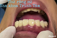 Nha khoa Trinh Tâm | Nha khoa trẻ em Tân Phú | Nha khoa nhổ răng khôn Tân Phú