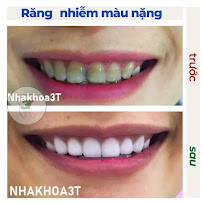 NHA KHOA 3T
