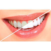 Nha Khoa OHIO (Uy tín, Chất lượng, Tiêu chuẩn Mỹ, Giá cạnh tranh)
