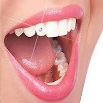 Nha Khoa OHIO (Uy tín, Chất lượng, Tiêu chuẩn Mỹ, Giá cạnh tranh)