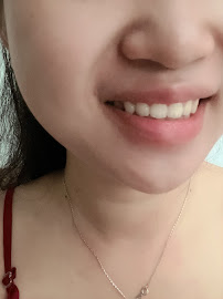 Nha khoa Thiên Sứ