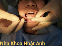 Nha Khoa Nhật Anh