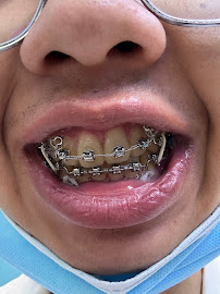 Nha Khoa Smile Hunter