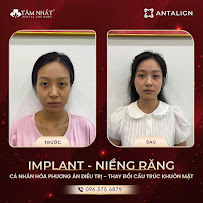 Tam Nhat Dental
