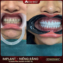 Tam Nhat Dental