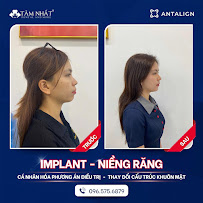 Tam Nhat Dental