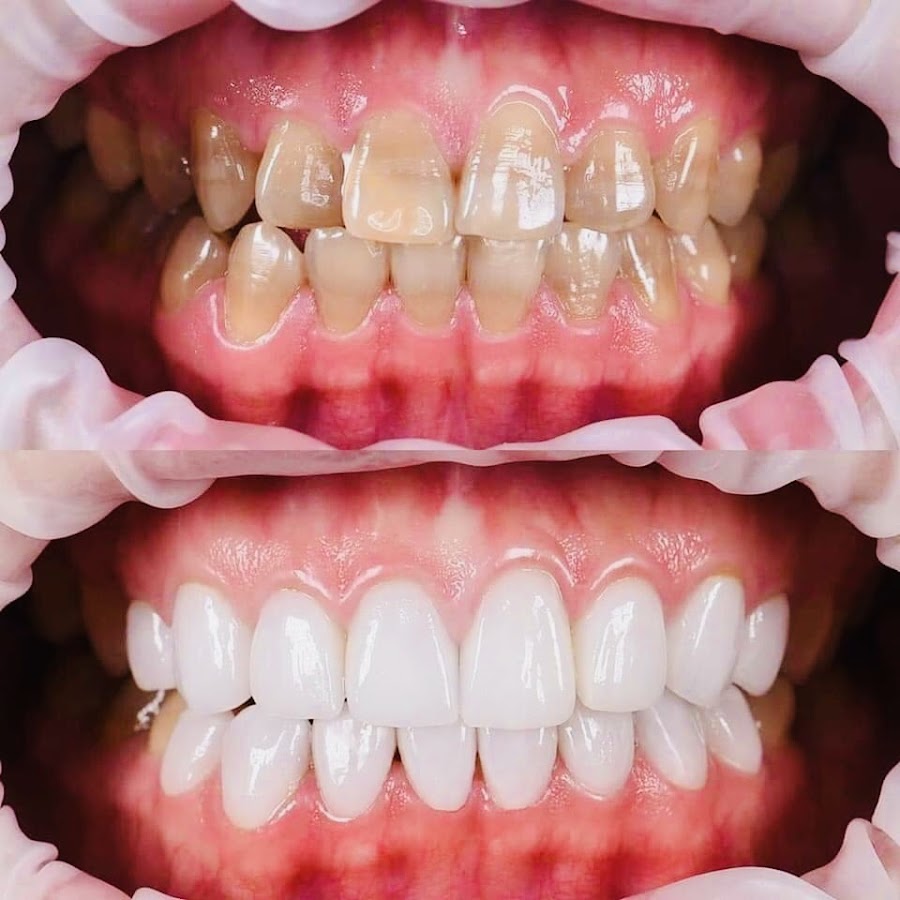 Viet My Dental Go Vap dental clinic