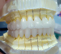 Nha khoa việt mỹ gò vấp