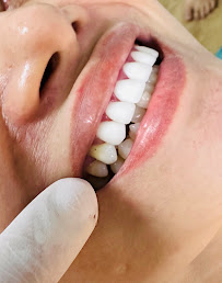Nha khoa việt mỹ gò vấp