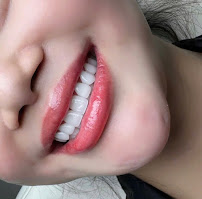 Nha Khoa Hồng Y - Gò Vấp