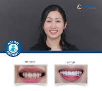 Westcoast International Dental Clinic (West Lake)