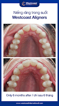 Westcoast International Dental Clinic (West Lake)