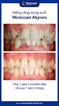 Westcoast International Dental Clinic (West Lake)