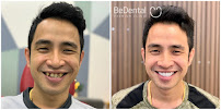 Be Dental - Nha khoa uy tín quận Đống Đa chuyên Làm răng sứ, niềng răng, chữa cười hở lợi