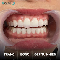 Be Dental - Nha khoa uy tín quận Đống Đa chuyên Làm răng sứ, niềng răng, chữa cười hở lợi