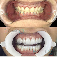 Be Dental - Nha khoa uy tín quận Đống Đa chuyên Làm răng sứ, niềng răng, chữa cười hở lợi