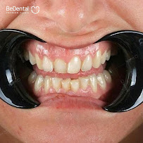 Be Dental - Nha khoa uy tín quận Đống Đa chuyên Làm răng sứ, niềng răng, chữa cười hở lợi