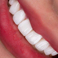 Be Dental - Nha khoa uy tín quận Đống Đa chuyên Làm răng sứ, niềng răng, chữa cười hở lợi