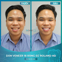 Be Dental - Nha khoa uy tín quận Đống Đa chuyên Làm răng sứ, niềng răng, chữa cười hở lợi