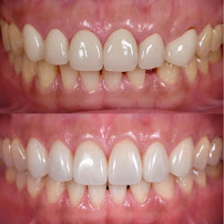 Be Dental - Nha khoa uy tín quận Đống Đa chuyên Làm răng sứ, niềng răng, chữa cười hở lợi