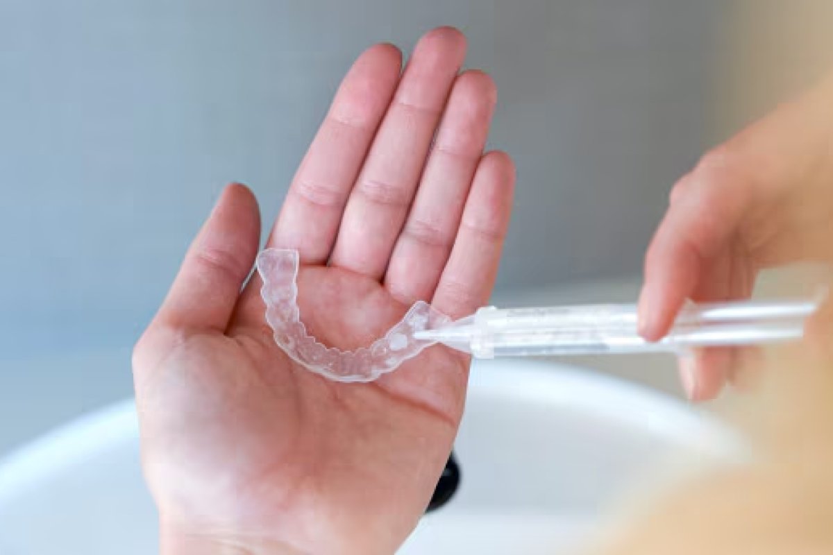 Teeth Whitening Take Home Kit in Vietnam: Cost Guide 2026