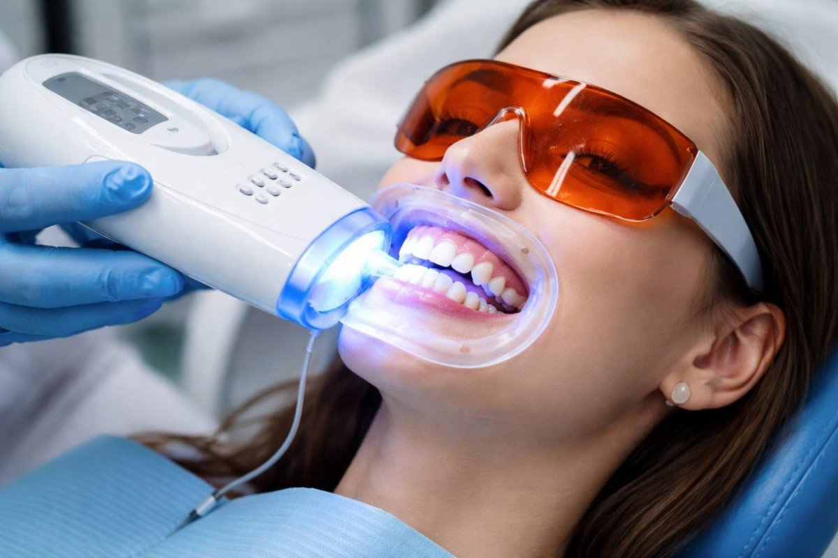 Teeth Whitening in Hoi An: Same-Day Guide for International Patients 2026