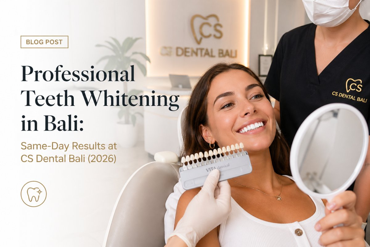 Professional Teeth Whitening in Bali: Same-Day Results at CS Dental Bali (2026)
