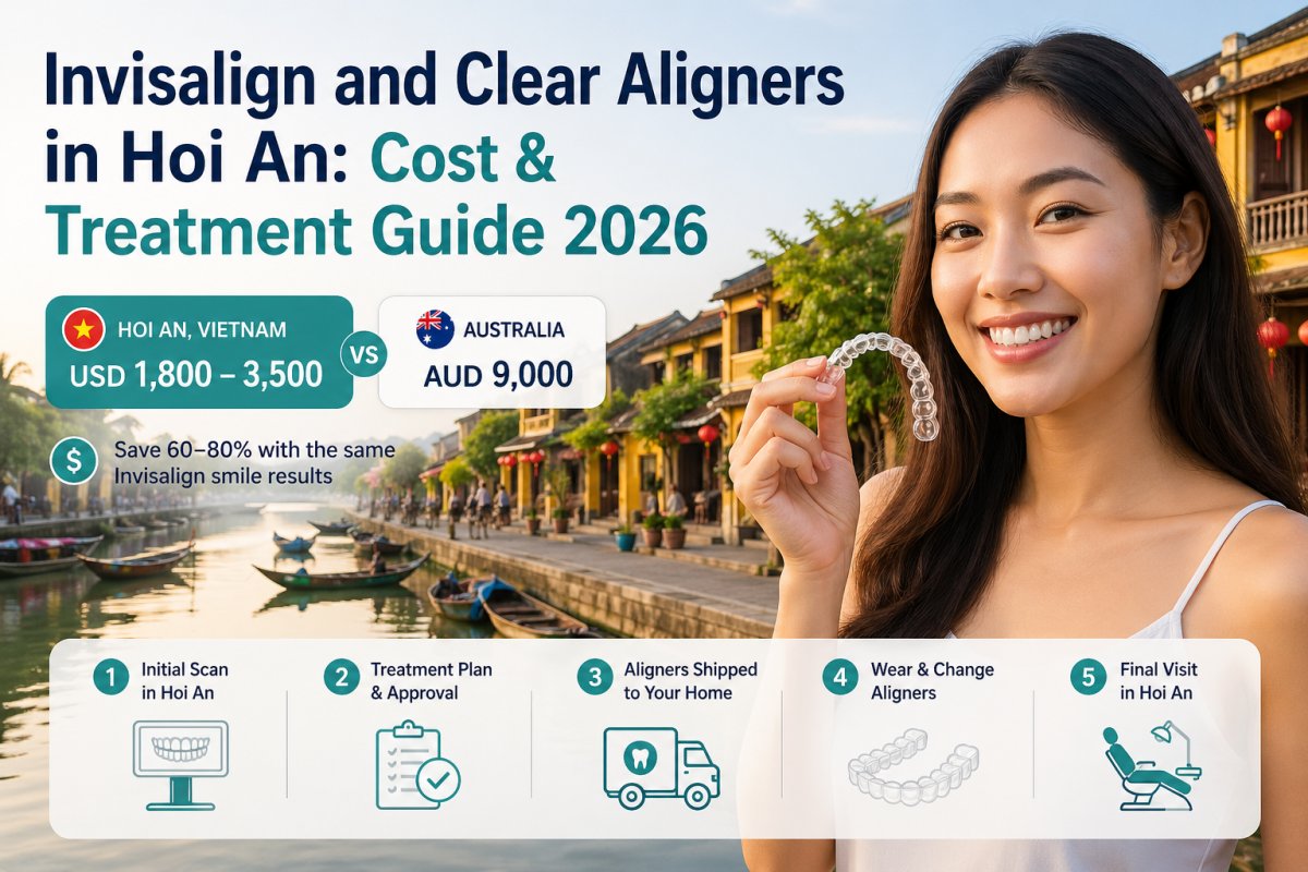 Invisalign in Hoi An 2026: Cost, Brands & How It Works | SmileJet