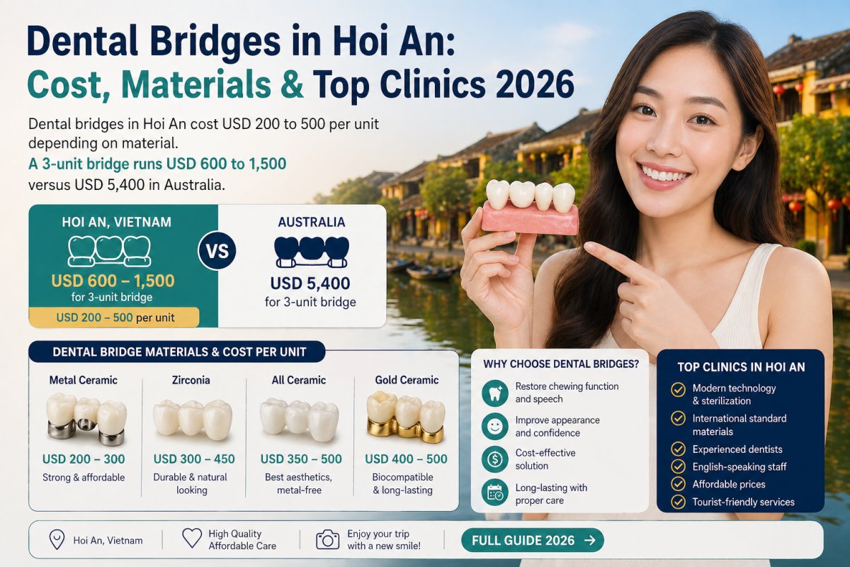 Dental Bridges in Hoi An 2026: Cost, Materials, Clinics | SmileJet