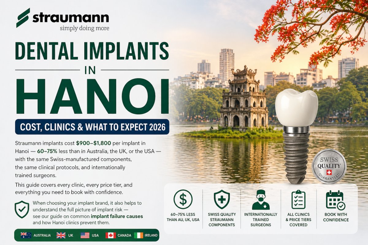 Straumann Dental Implants in Hanoi: Cost, Clinics & What to Expect 2026
