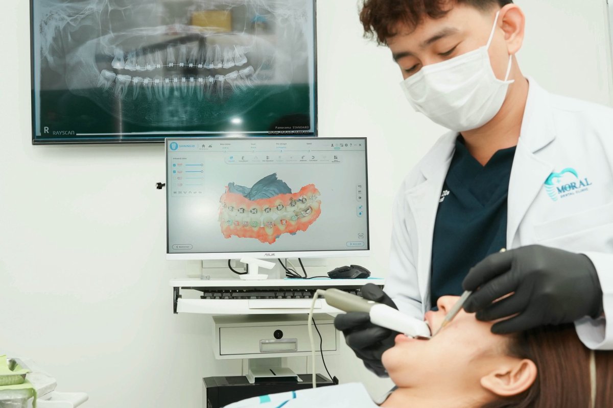 Dental Implants at Moral Dental Clinic: Brands, Materials, and What to Ask
