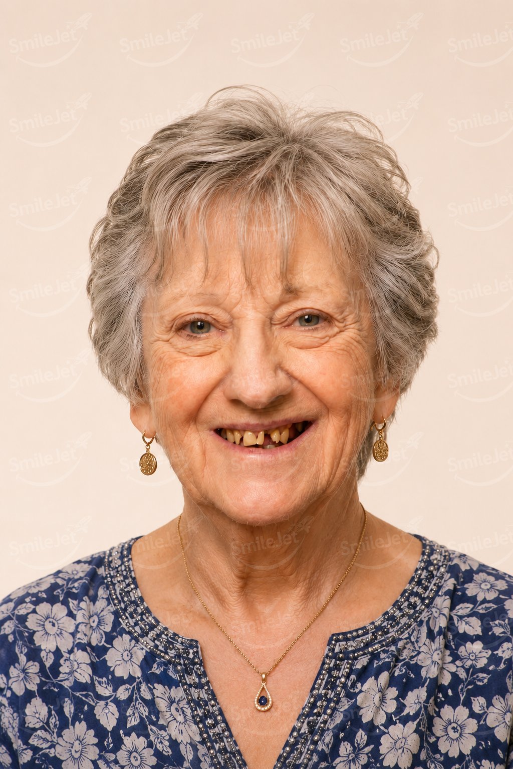 Before: Marlene from Australia: All-on-4 in Vietnam