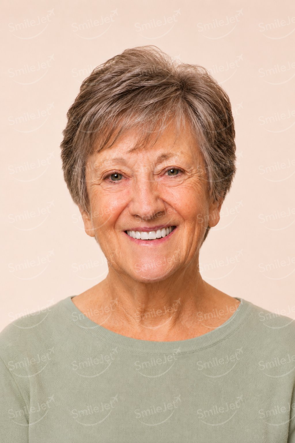After: Marlene from Australia: All-on-4 in Vietnam