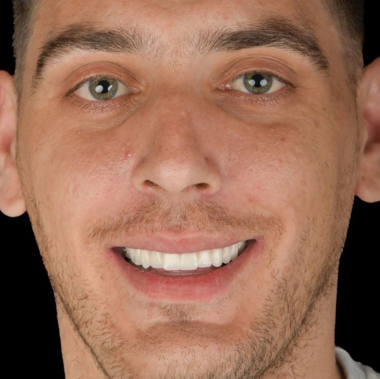 I Was Done With Dentures. Vietnam Gave Me My Life Back