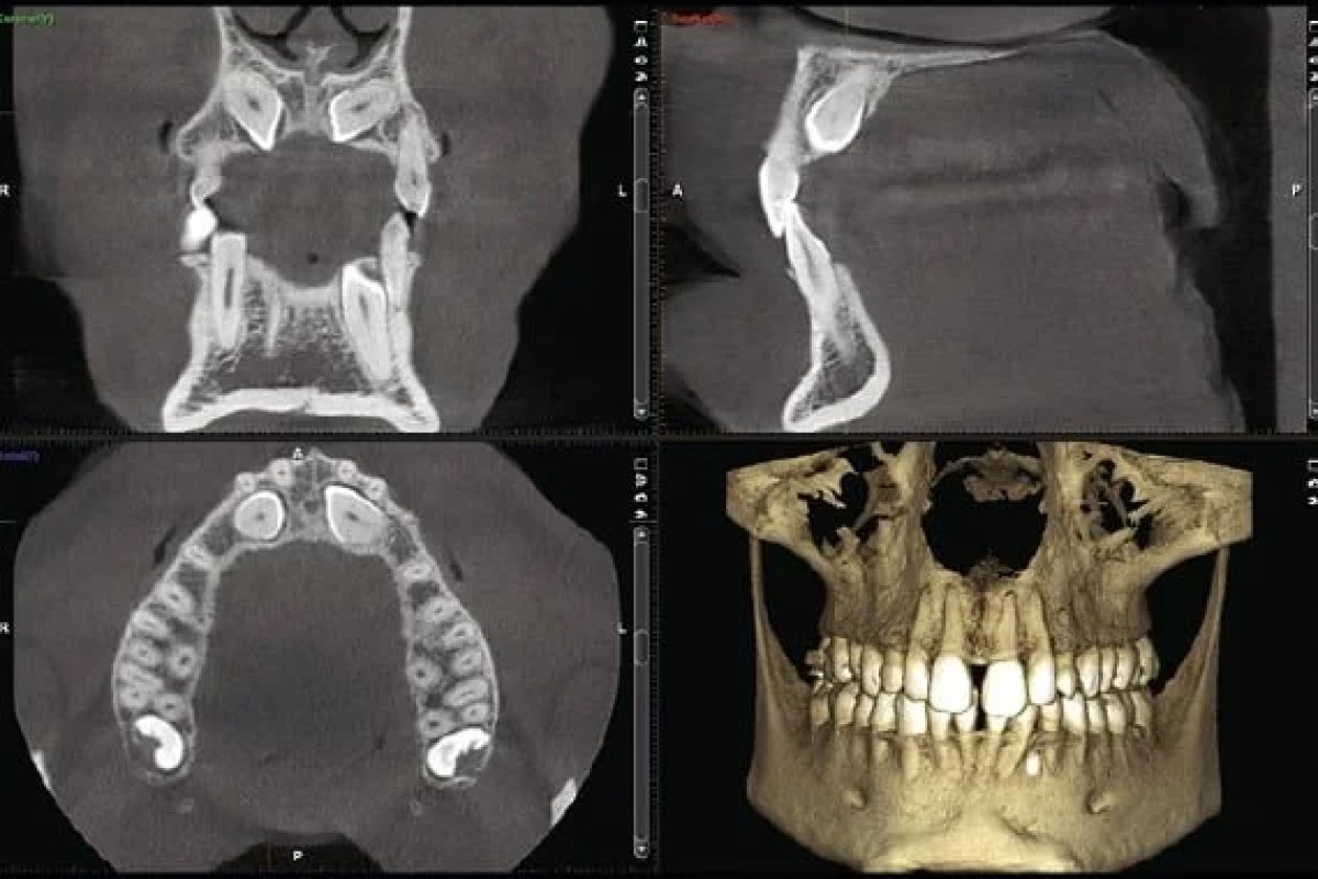 CT Scan/3D X-ray in Vietnam