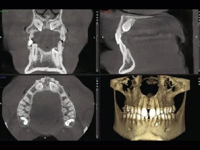 CT Scan/3D X-ray